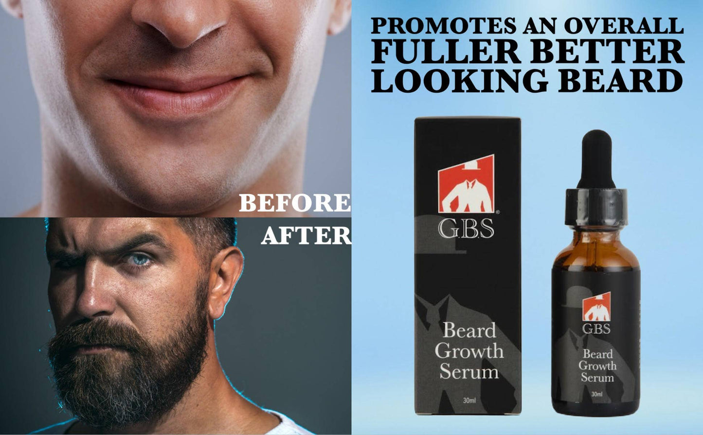 GBS - GBS Beard Growth Kit